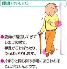 keishuku.png